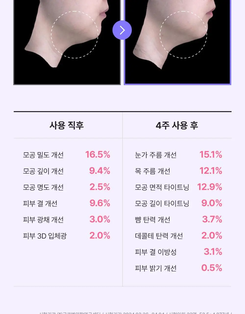 [모공교정] 아이디플라코스메틱 엑소브이 프로리프팅 세트(리프팅 앰플 5ml + MTS 롤러) 상세페이지 35